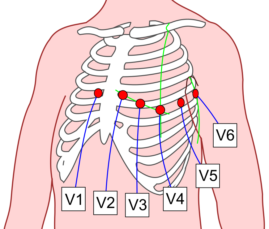 Posizione elettrodi precordiali (da commons.wikimedia.org: Precordial_Leads_2.svg
